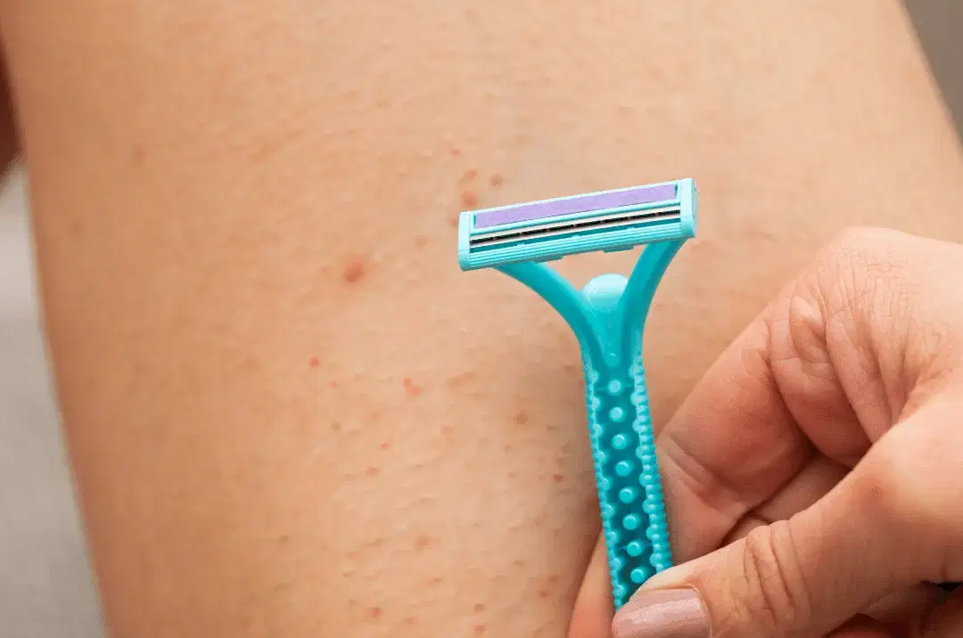 How to Get Hairless Fast: Quick Hair Removal Strategies